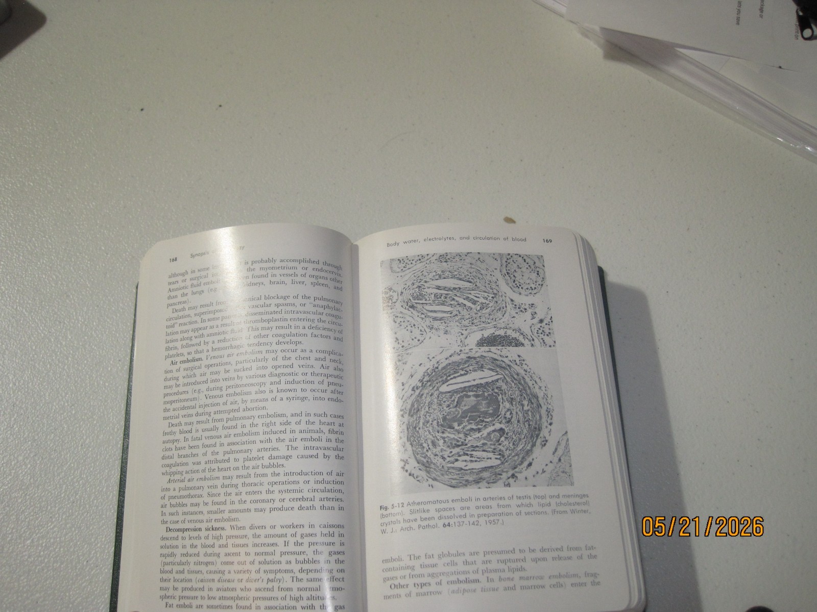 Vintage medical book Synopsis of Pathology 9th edition Anderson, Scotti 1976