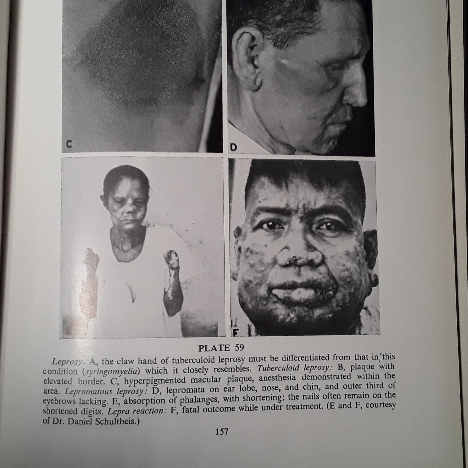 Practical Dermatology by George M. Lewis M.D. (Hardcover 1955)