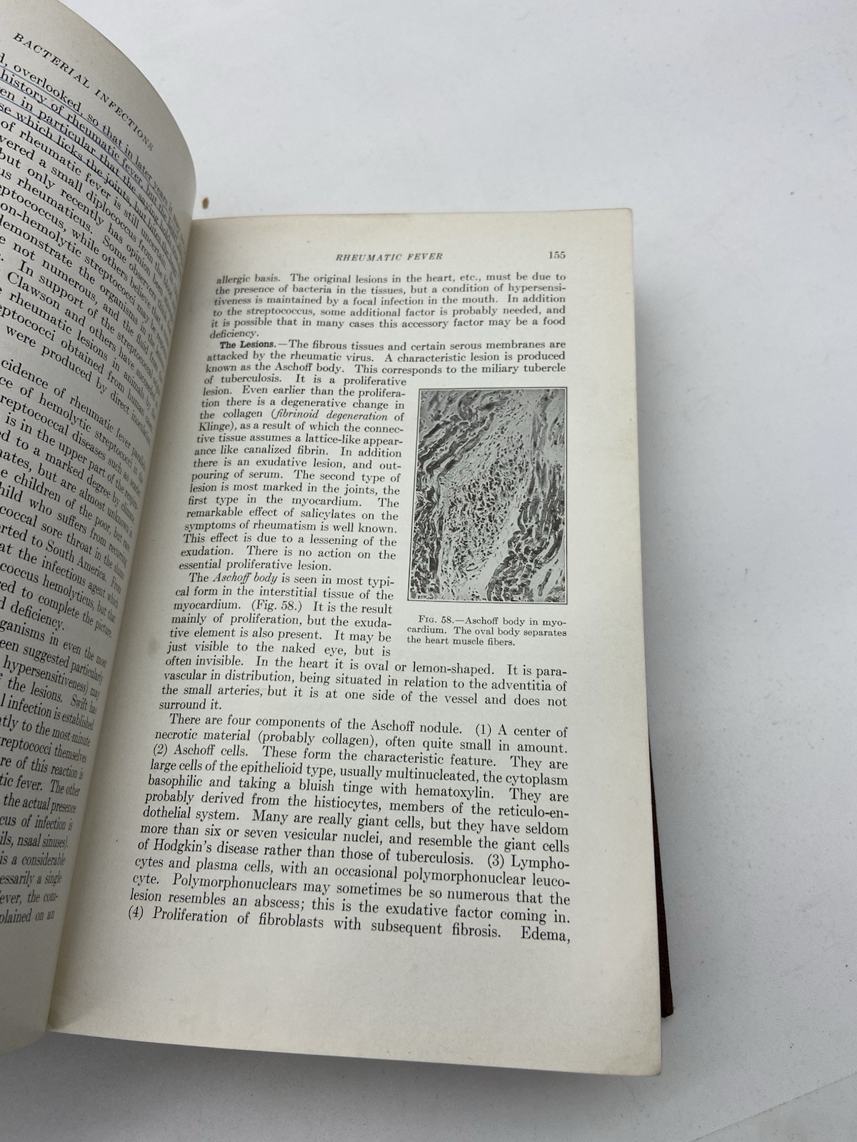 A Textbook Of Pathology by William Boyd Hardcover 1943 4th edition Fourth HBA