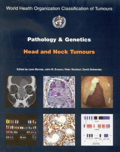 Pathology and Genetics of Head and Neck Tumours [OP] (Medicine) – The Intern…